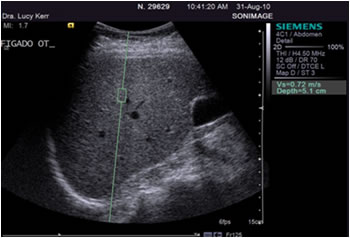 Exames funcao hepatica
